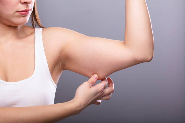 How to Get Rid of Flabby Arms? Follow these Tips for Best Results