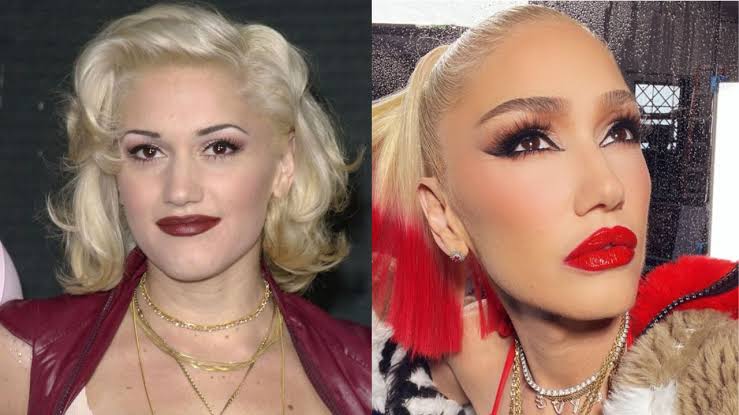 Did Gwen Stefani Undergo Plastic Surgery Before And After Photos Explored The Teal Mango