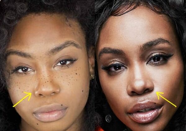 After SZA's big break, her face started to look different